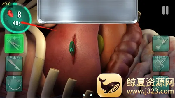 ҽԺ����ʱ��(����ģ����Ϸ)